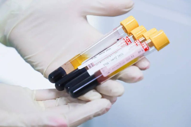 В клинико-диагностической лаборатории на базе Домодедовской больницы выполняется до 30 тысяч исследований